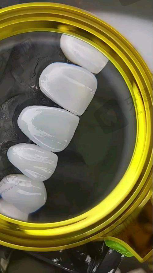 哪些牙齿更适合做超薄全瓷贴面？