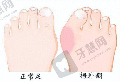 五、武汉美莱医疗美容医院乳房提升手术价格