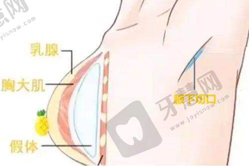 芜湖瑞丽医疗美容门诊部真人口碑评价怎么样？