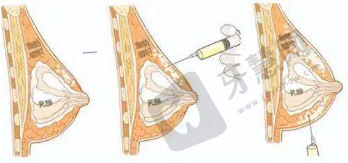 深圳阳光医院收费价目表全新