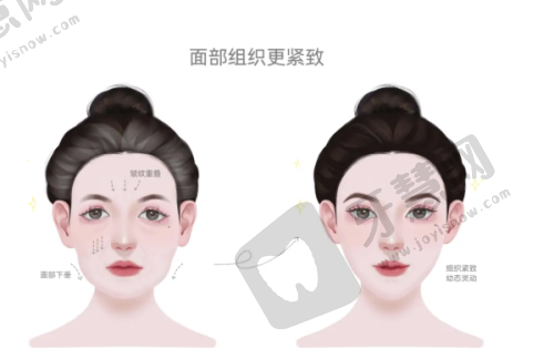 2025深圳吸脂医院排名前10怎么样