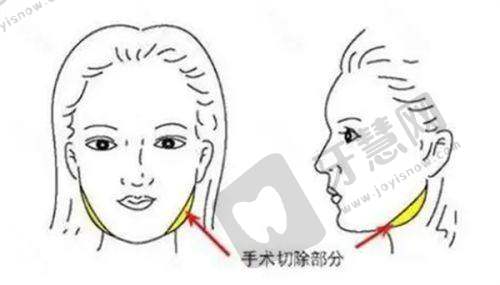 LOOK七:郑州丽天罗明生医生技术素养如何?