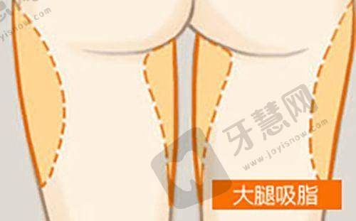 五、北京轻美颜眼袋提升医院医生简介