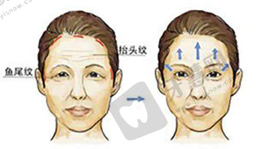 深圳阳光医院收费价目表最新曝光！多项检查、治疗项目价格大揭秘，速来查询！