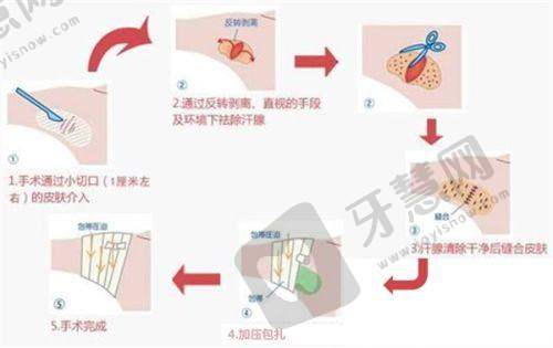 四、武汉五洲整形医院的价格合理性探讨