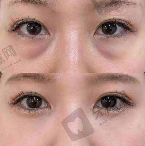 980元优惠如何预约？