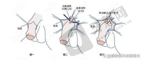 四、哈尔滨雅美整形医院项目特色