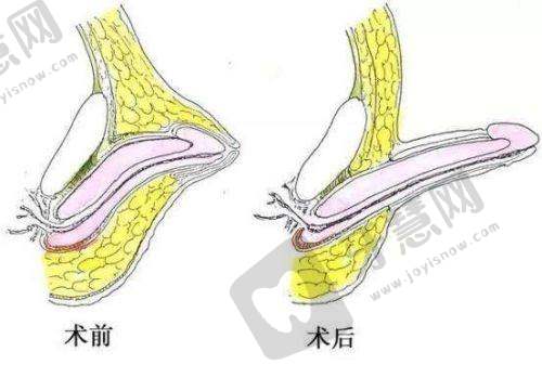 北京芳园整形医院口碑好不好？附真实患者口碑评价