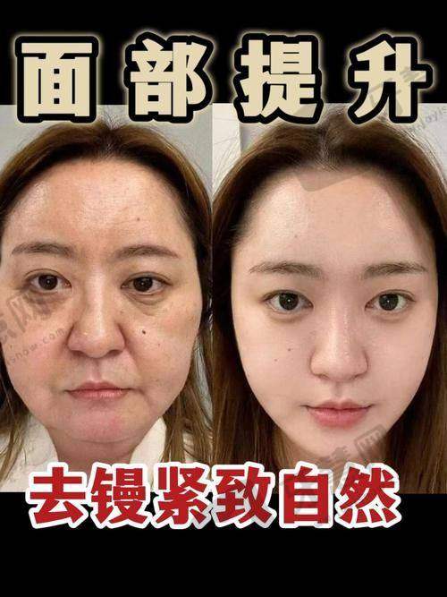 总结