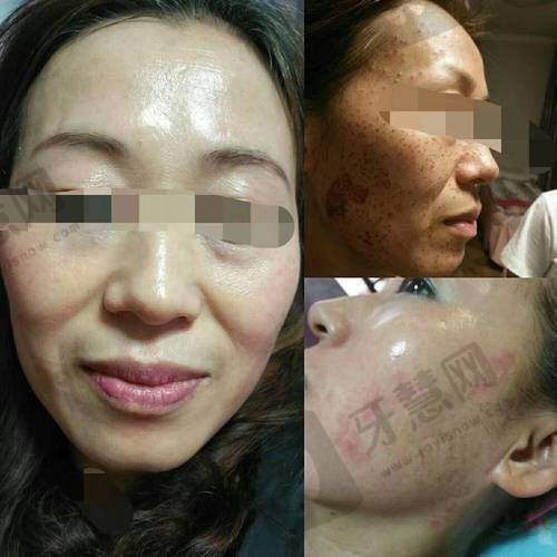 李艳医生的擅长项目介绍