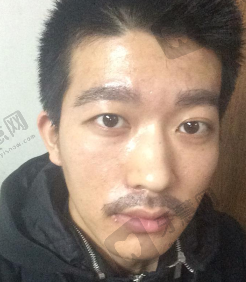 哈尔滨华美整形医院项目特色