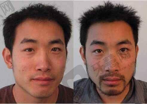 哈尔滨华美整形医院怎么样，口碑评价如何？