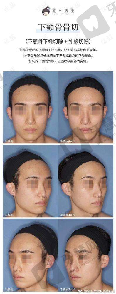 北京丽景湾医疗美容门诊部口碑好不好？附真实患者口碑评价