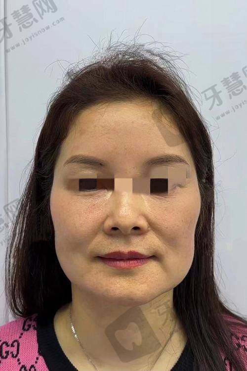 公美华医生的顾客好评实例