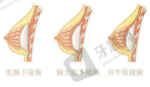 北京纯脂美容皮层光焊 20750 元起之如何预约