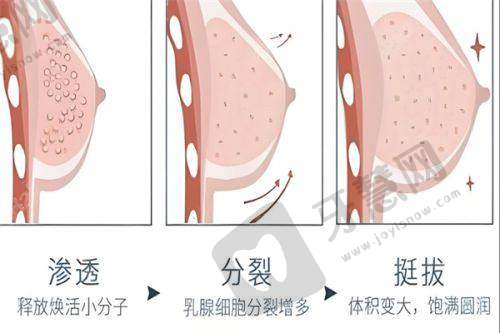京岩之畔医巢美容皮秒激光去疤痕 7750 元起划算吗