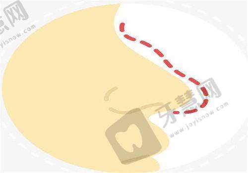 北京乳头内陷矫正排名前十——北京维尔口腔（小庄分院）