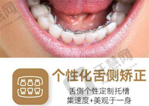 张划医生的技术优势：精细矫正与效率高治疗