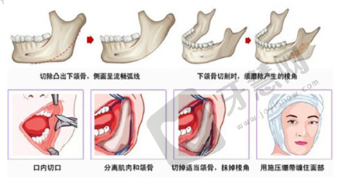 北京纯脂美容皮层光焊 20750 元起之医生简介