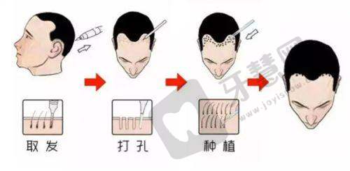 北京百达丽美容皮肤软组织扩张 43750 元起之项目价值