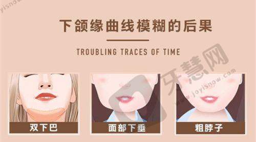 李辉医生坐诊的眼鼻整形门诊部