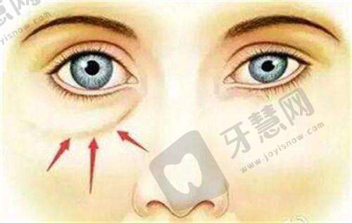 三、深圳阳光微整形收费标准