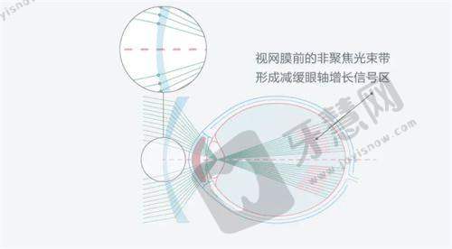 成都普瑞眼科医院的性质：国有还是私立？