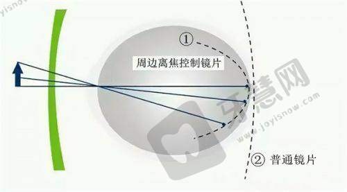 成都普瑞眼科医院正规吗？公立还是私立？正规私立连锁眼科实力很出色