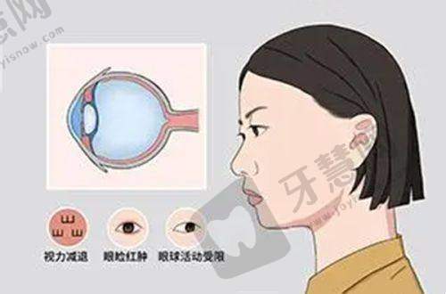 结语:乌鲁木齐普瑞眼科高新院,值得信赖的眼科之选