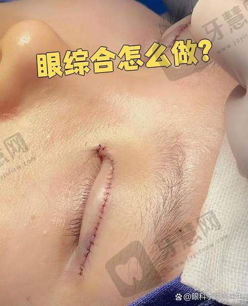 北京空美圣医整形自体脂肪丰泪沟 20750 元起优势详解