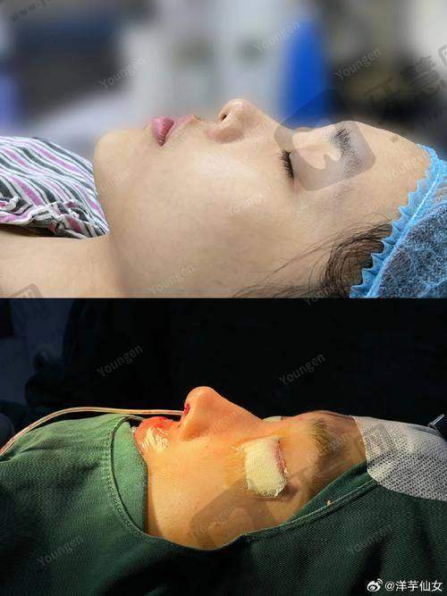 北京百达丽美容皮肤软组织扩张 43750 元起之预约方式