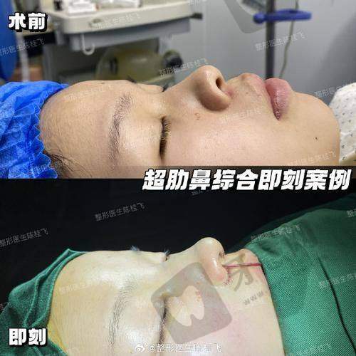 北京百达丽美容皮肤软组织扩张 43750 元起之交通指南