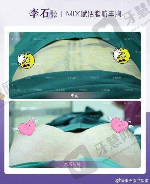 北京芳园整形自体脂肪丰耳垂 6750 元起如何预约