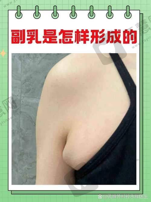 北京副乳吸脂十大排名医院，齐越/高超医生领衔12800元起分层吸脂技术