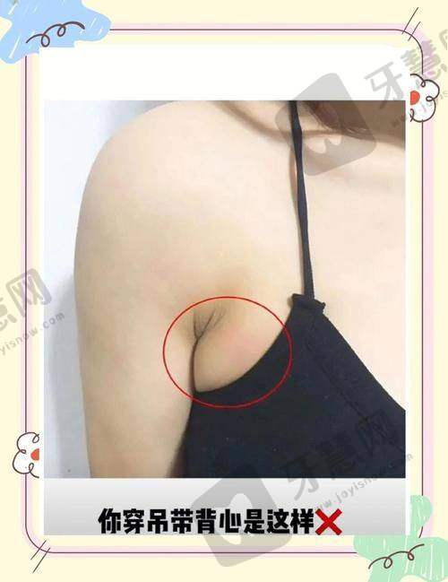 北京手术去副乳十大排医生院——北京丽都医疗美容医院