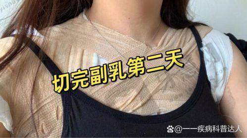 北京巨乳缩小排名前十——北京京城皮肤医院详情