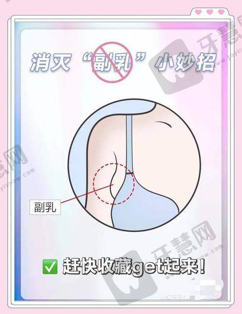北京手术去副乳十大排医生院——北京大学人民医院