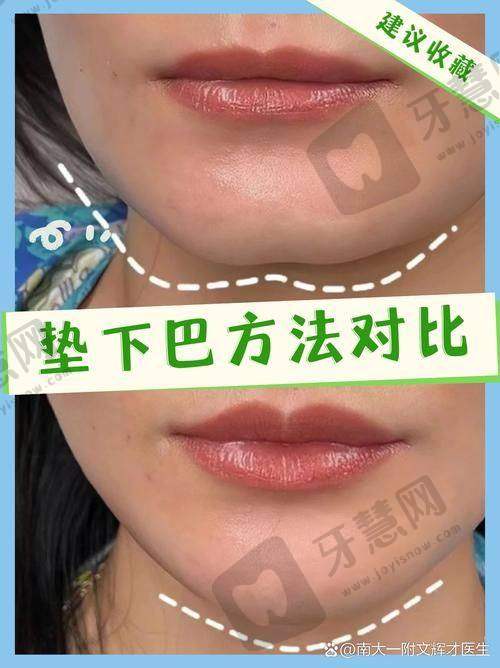 北京纯脂医疗美容 - 脂肪移植老牌机构