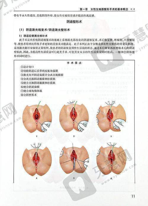 北京泰美丽格美容小阴唇整形 13750 元起项目详细介绍