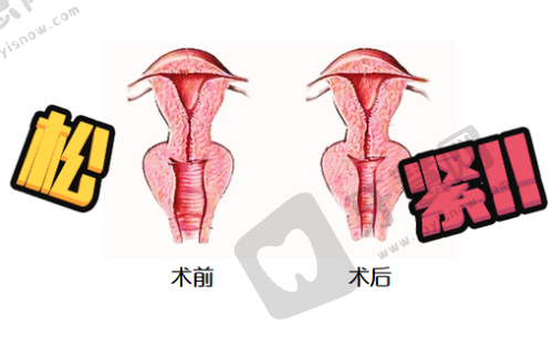 北京泰美丽格美容小阴唇整形 13750 元起医生团队实力