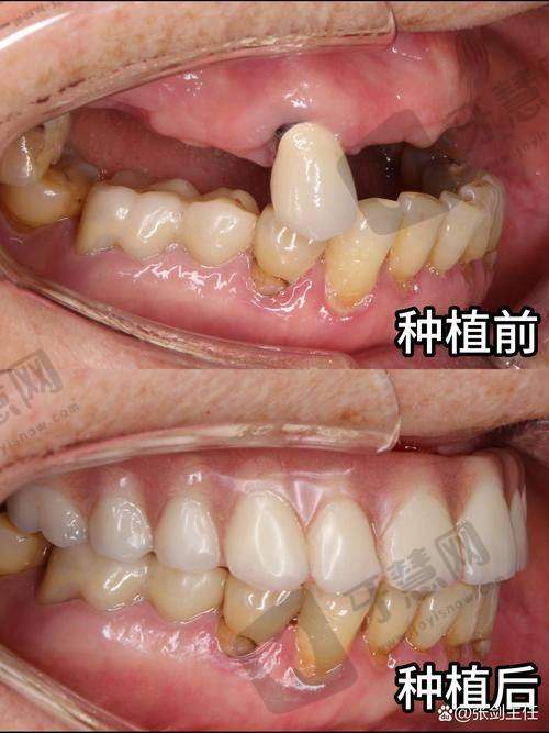 莲塘牙医诊所比较好的是哪家