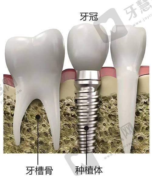 深圳莲塘口岸附近好的牙科医院有哪些