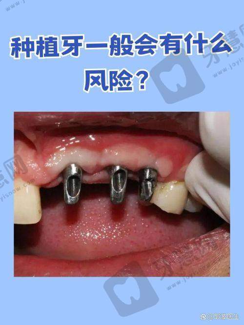 北京中鸿口腔门诊部王同勇医生的顾客好评