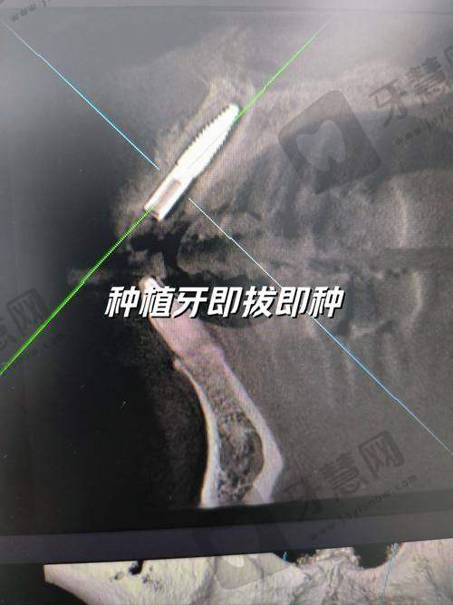 北京中鸿口腔门诊部王同勇医生的擅长项目