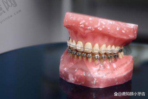 苏州英博口腔怎么样？是正规牙科医院吗？种植牙效果、收费价目与门诊部地址大揭秘！