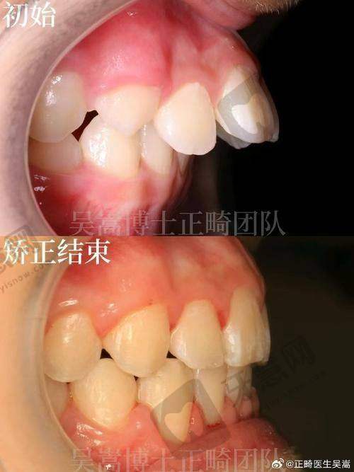 顾客好评:值得信赖的口腔矫正医生