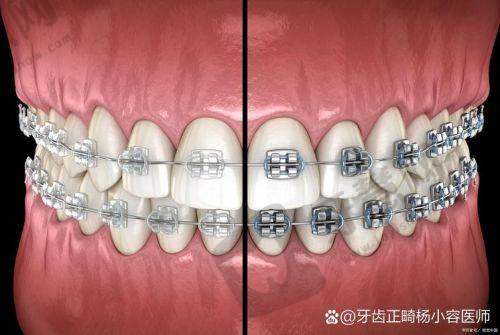 深圳观澜牙科医院技术哪家强
