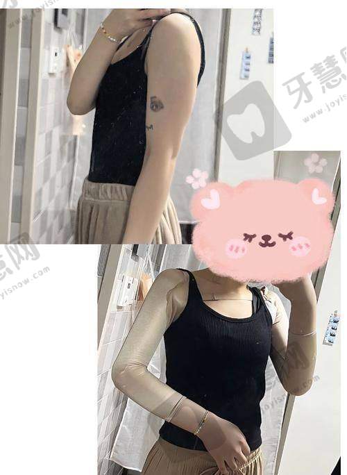 北京副乳吸脂十大排医生院——北京禾美嘉医疗美容