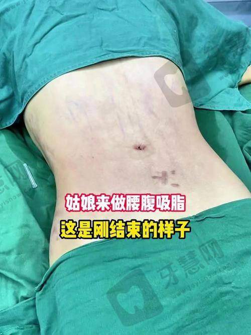 北京嘉禾整形医院——综合性全身吸脂医院