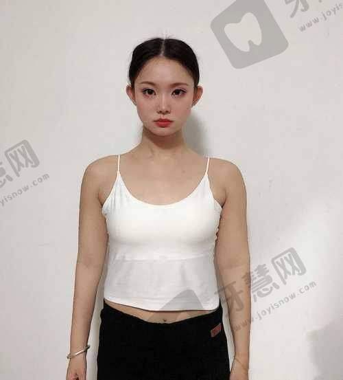 北京全身吸脂前十的医院公布：纯脂/润美玉之光|冯斌/王明利技术解析
